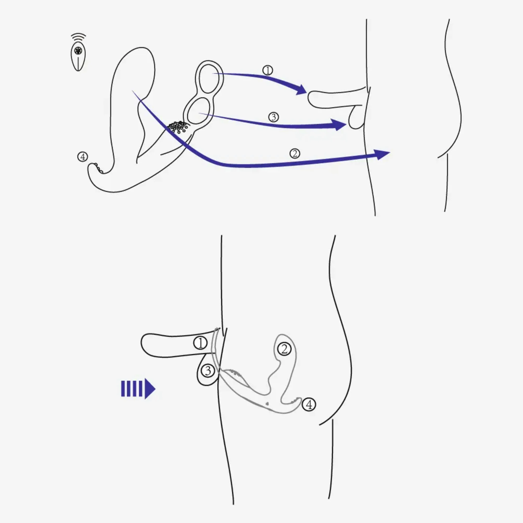Prostate Curve Dual Ring - Remote Control Vibrating Prostate Massager
